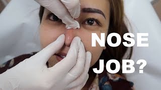ANG BAGO KONG ILONG AT IBA PANG MGA GANAP - anneclutzVLOGS