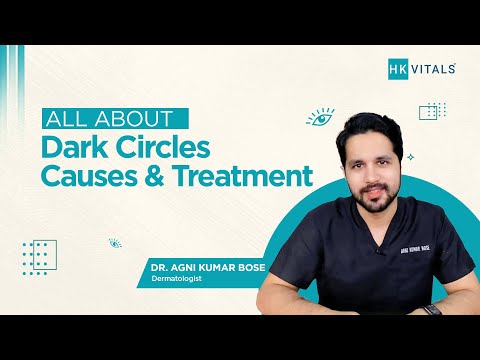 Dark Circles No More: Effective Treatments to Regain Radiant Skin | Dr. Agni | HK Vitals