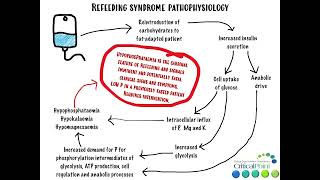 Refeeding Syndrome