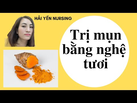 Trị MỤN bằng nghệ tươi/Cách trị mụn TRỨNG CÁ bằng nghệ tươi/Hải Yến Nursing