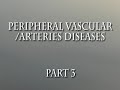 Peripheral Vascular/Arterial Diseases Part 3
