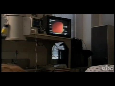 Katie Couric's Colonoscopy for SU2C
