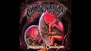 Watch Malignancy Fried Afterbirth video