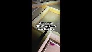 Can Mold Impact Your Liver?