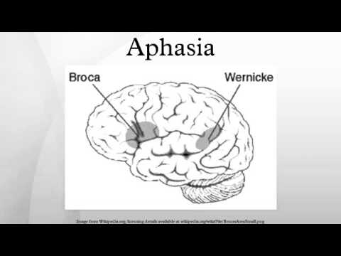 wernickes aphasia disorder essay Receptive aphasia the fluent aphasias as the thought disorder of schizophrenia develops this is also referred to as wernicke's or receptive aphasia. wernickes aphasia disorder essay Receptive aphasia the fluent aphasias as the thought disorder of schizophrenia develops this is also referred to as wernicke's or receptive aphasia.