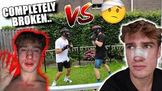 My Best Friend Broke My Nose In A Fight...