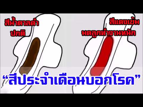 “เผย 7 สี” ประจำเดือนบอกโรค