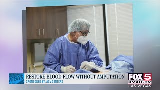 Watch Blood Amputation video