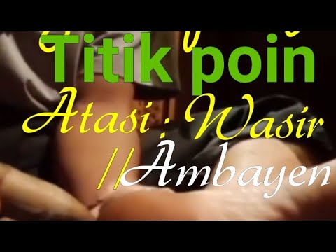 Pijat refleksi ( reflexzologi ) atasi ambein/ wasir .