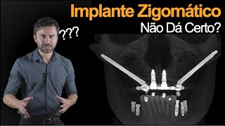Será Que é Por Isso Que Implante Zigomático Não Dá Certo?