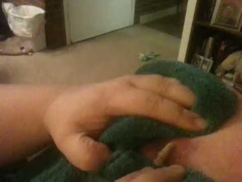 GROSS!! Popping a huge nasty boil! LOT'S of Pus! Pimple Zit Cyst