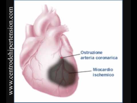 partes del corazon. partes del corazon. partes del corazon.