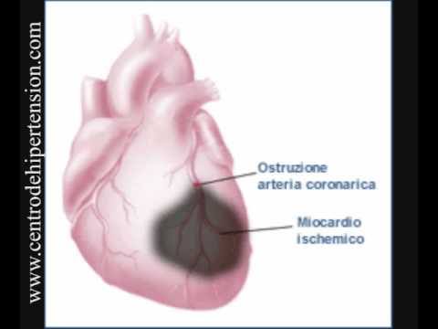 partes del corazon. 4 partes del corazon- parte 3