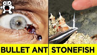 Top 10 Most Painful Things Ever Experienced In The World Top 10 Most Painful Things Ever Experienced In The World