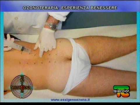 Fotografia di malattia di psoriasi sulla testa