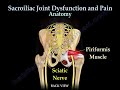 Sacroiliac Joint Dysfunction Animation - Everything You Need To Know - Dr. Nabil Ebraheim, MD