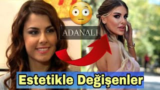 Esteti̇kle Deği̇şen Türk Ünlüler Çok Şaşiracaksiniz
