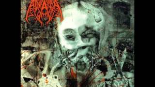 Watch Anata Shackled To Guilt video