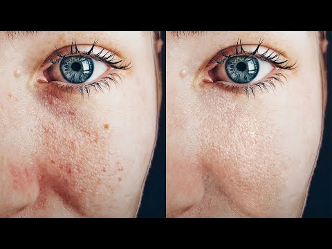 Xử Lý Da Nhanh Và Tự Nhiên Bằng Photoshop | Thùy Uyên