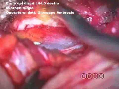 Il dorso in una vita fa male che togliere