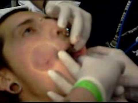 cheek piercings