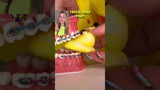 Easter Candy You Can Cant Eat With Braces Peeps Edition Orthodontist Reacts Crunchy Asmr Teeth