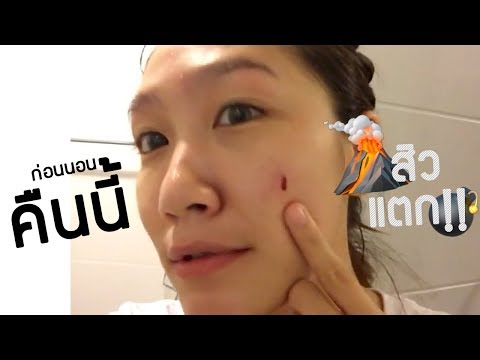 ก่อนนอนคืนนี้ ep.1 วิกฤตสิวแตก! และหนทางเอาตัวรอดให้สิวหายไปอย่างไวที่สุด l Dujdow