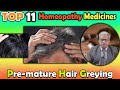 Pre-mature Hair Greying: Causes and #homeopathy Treatment -- Dr P S Tiwari