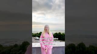 Albino Xəstəlik Deyil Gözəllikdir