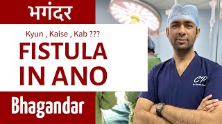 Kyun , Kab , Kaise Fistula Bhagandar Treatment Ka Ilaaj ? Operation Ya Bina Surgery भगदर