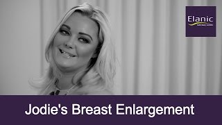 Breast Augmentation At Elanic