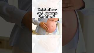 Tonjolan Pusar Yang Berbahaya Untuk Bumil
