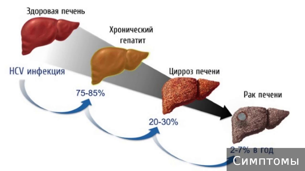 Секс С Больным Гепатитом С