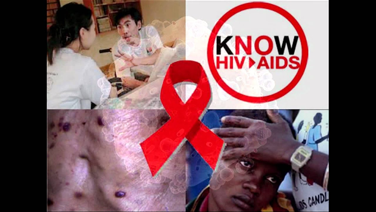 Aids Hiv Dissertation