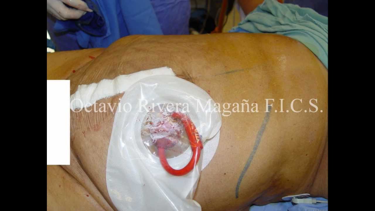 El muchacho con un pequeño miembro con la tía madura