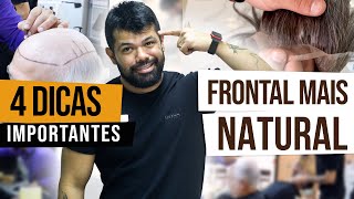 DEIXE A FRONTAL DA SUA PRÓTESE CAPILAR MAIS NATURAL | Dicas importantes!!