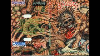 Watch Avulsed Deformed Beyond Belief video