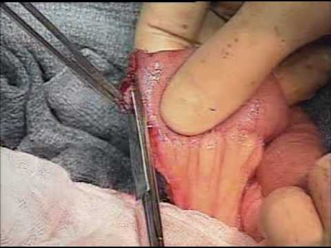 Surgical Operation surgery