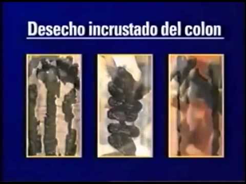 Tanto como que curar la psoriasis en el cuerpo
