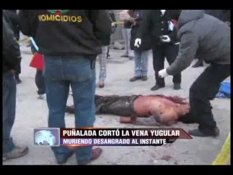 Il phlebologist nellarea costiera di SPb secondo la politica