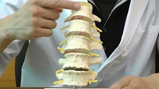 椎間板ヘルニアと変形性脊椎症モデル：動画