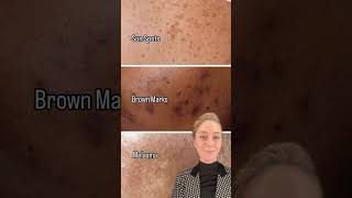 Solutions For Clogged Pores, Hyperpigmentation, & Body Concerns