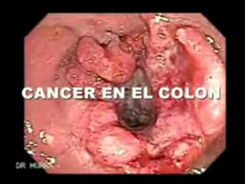 Los parásitos de las plantas superiores