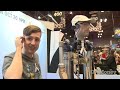 Meet the $1M bionic man