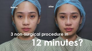 Nose Lift, Pouty Lip And Undereye Filler In 12 Minutes