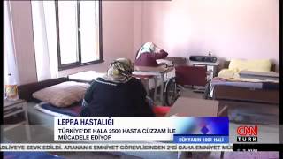 Dünyanın 1001 Hali-Cüzzam Ve Türkan Saylan