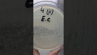 Growth Of E.coli Bacteria Microbiology Lovers