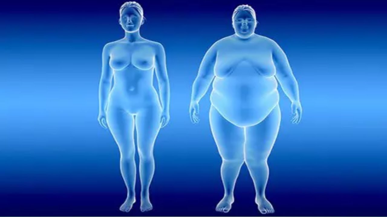 Лишний Вес И Ожирение Разница