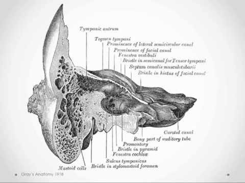 Mastoiditis - USMLE Step 2 Review Mastoiditis - USMLE Step 2 Review