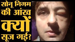 Sonu Nigam की ये दो फोटोज़ देखकर आपको क्यों डरना चाहिए The Lallantop Sonu Nigam की ये दो फोटोज़ देखकर आपको क्यों डरना चाहिए The Lallantop